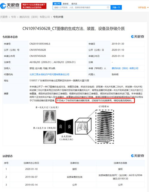 腾讯CT图像专利正式授权